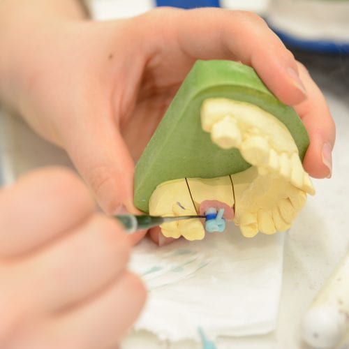 Zahnarbeiten Zahntechnisches Labor Bilodent Biel
